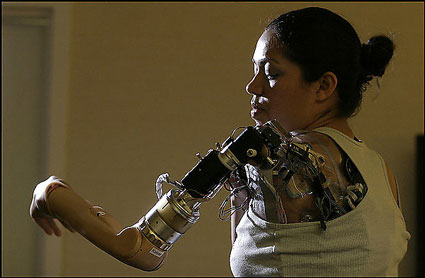 claudia mitchell bionic arm